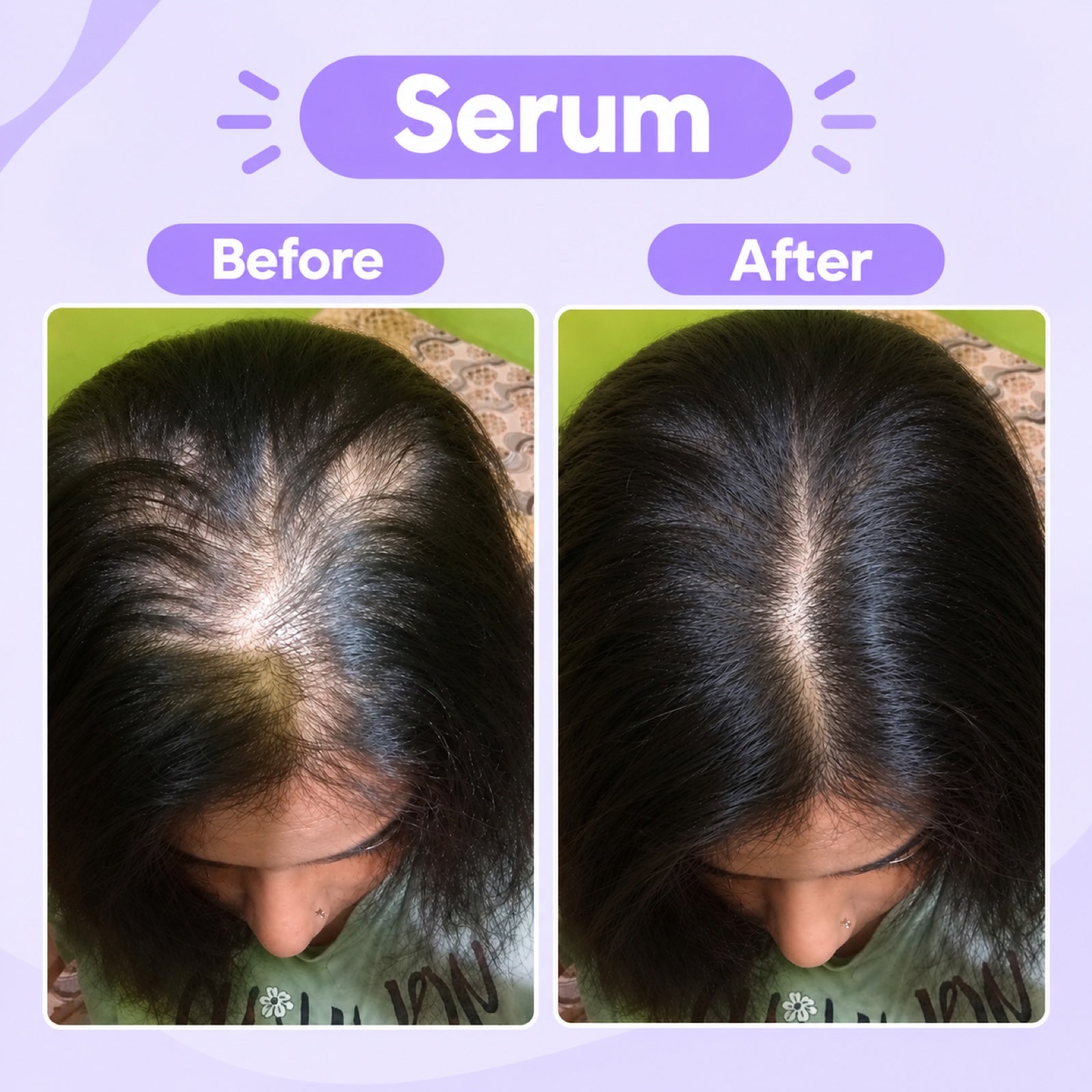 Complete Hair Repair Kit 4