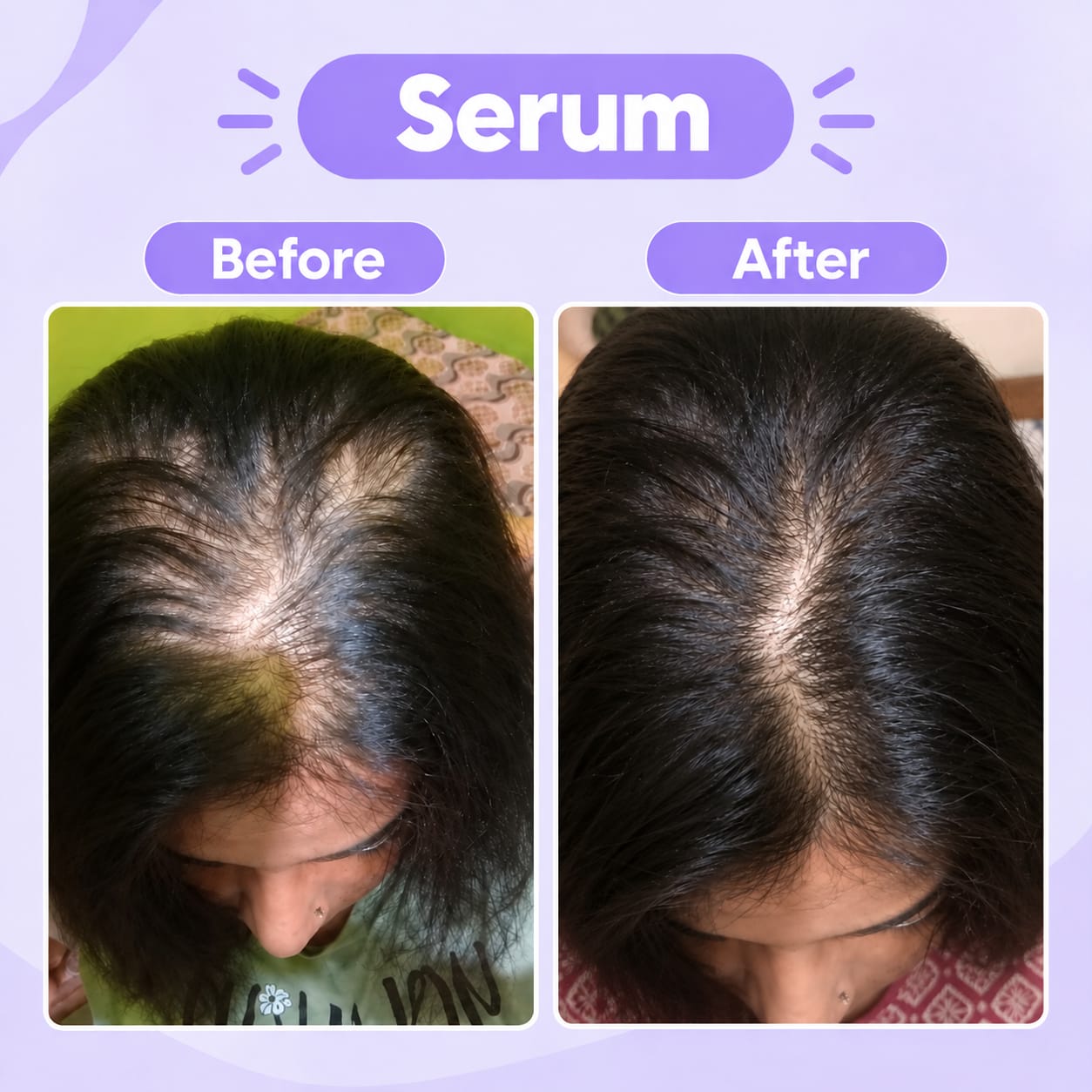 3-in-1 Hair Care Combo 2