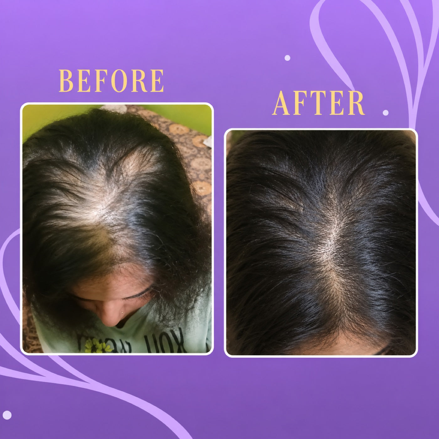Scalp Nurture Hair Serum Duo 2
