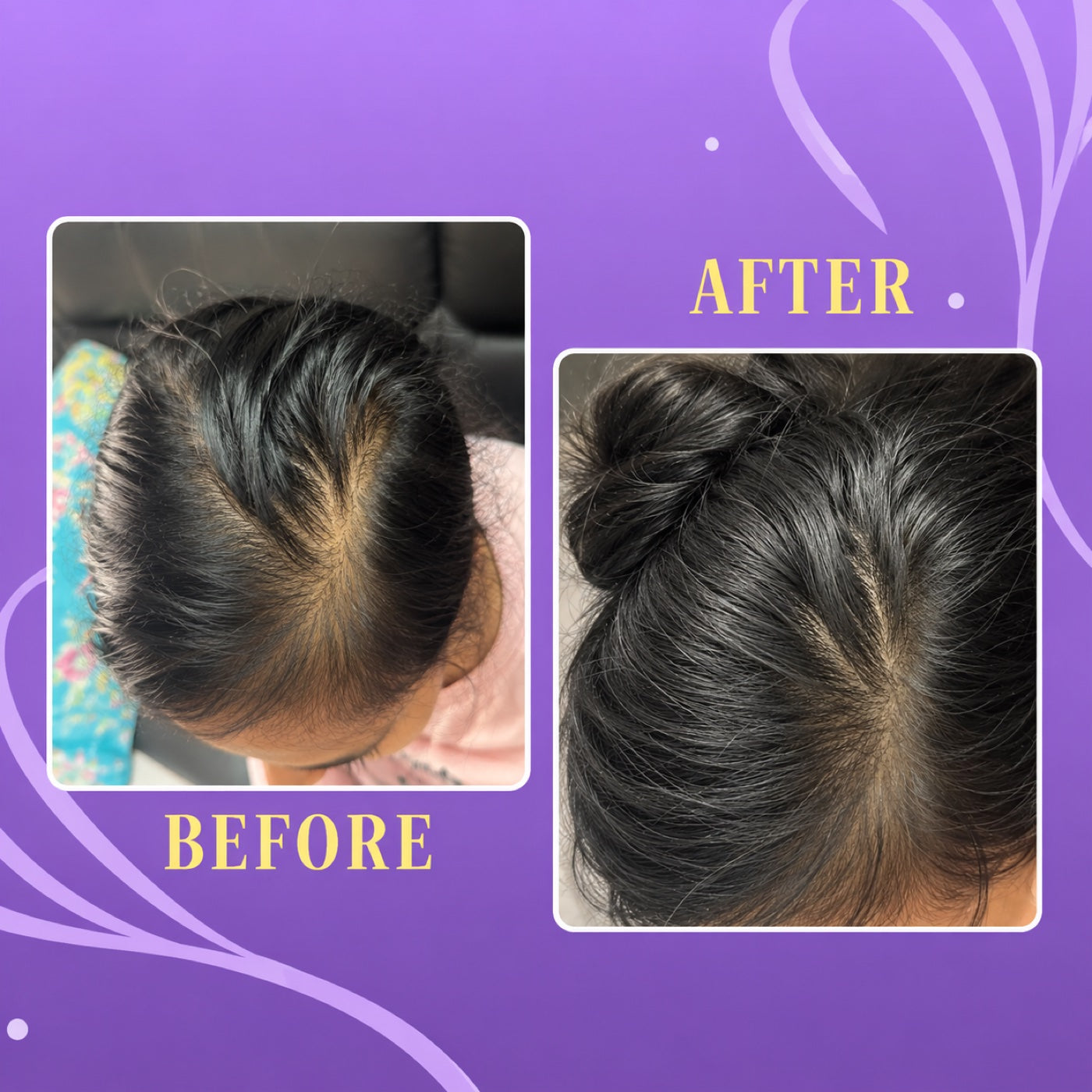 Scalp Nurture Hair Serum Duo 3