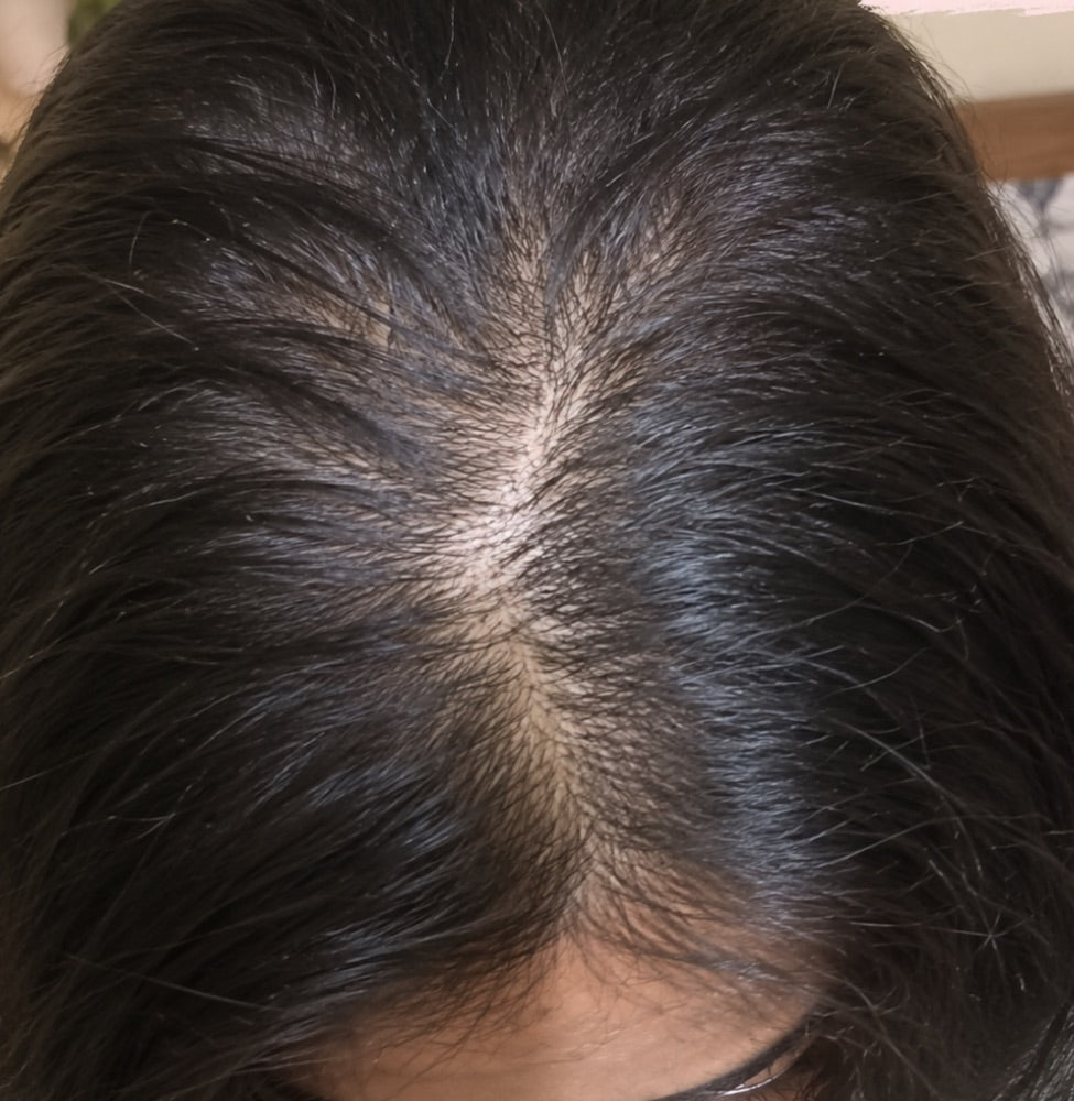 Arati hair Day 45