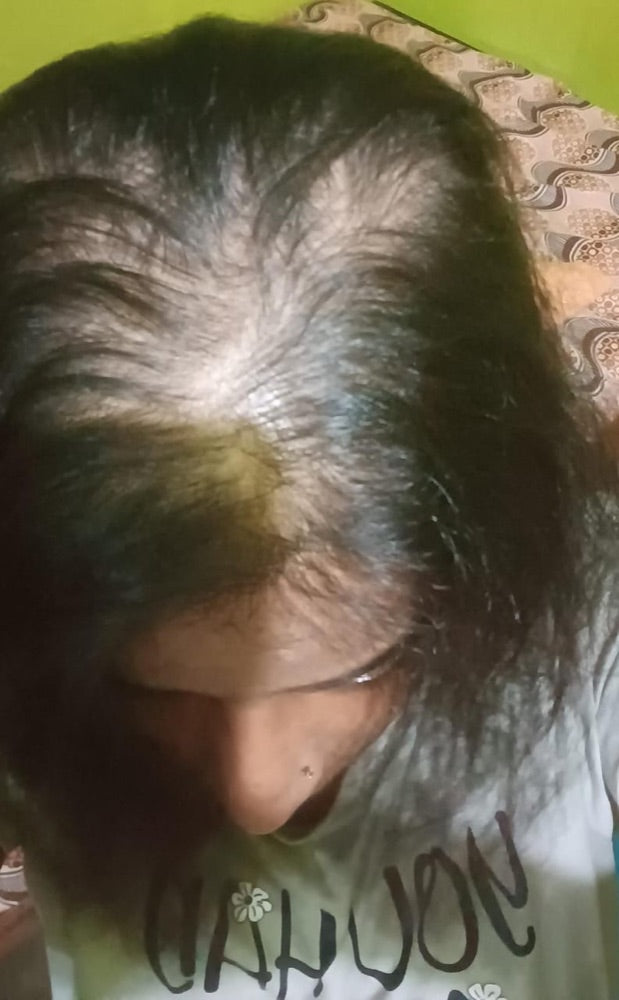 Arati hair Day 0