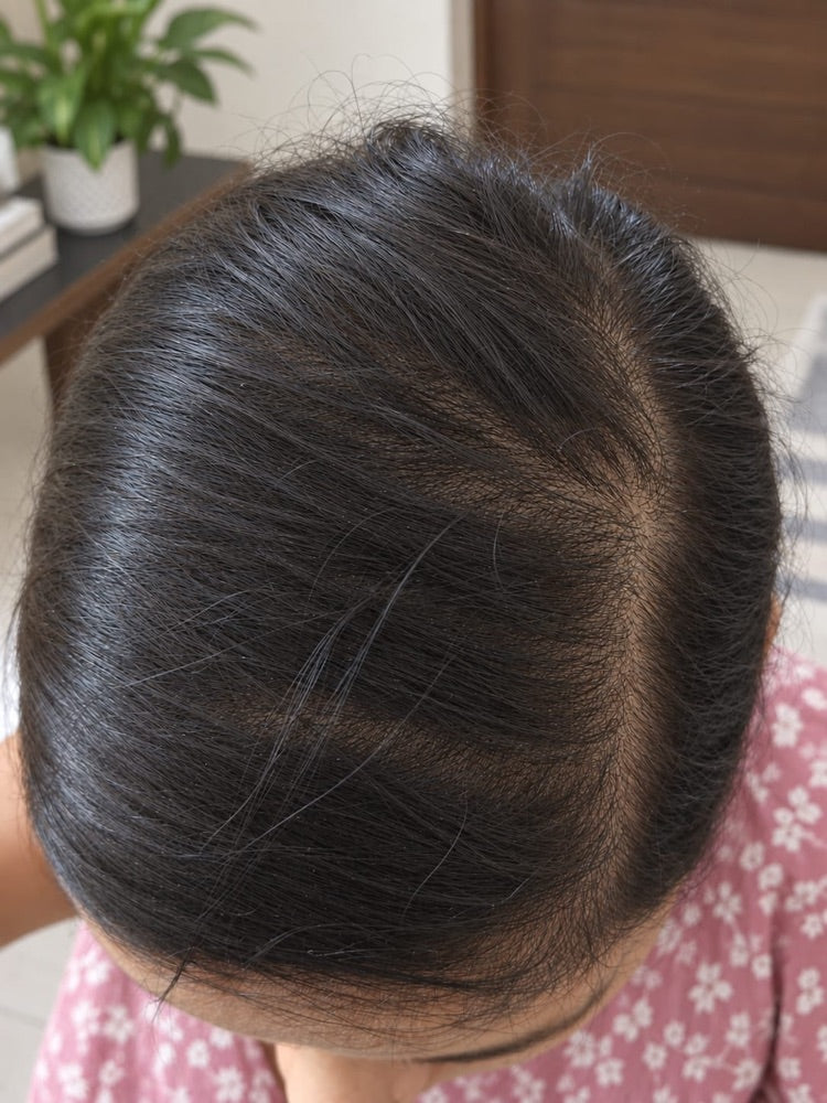 Hair Serum transformation 2 Day 45
