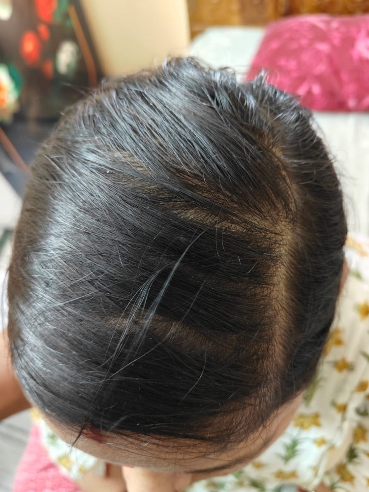Hair Serum transformation 2 Day 0