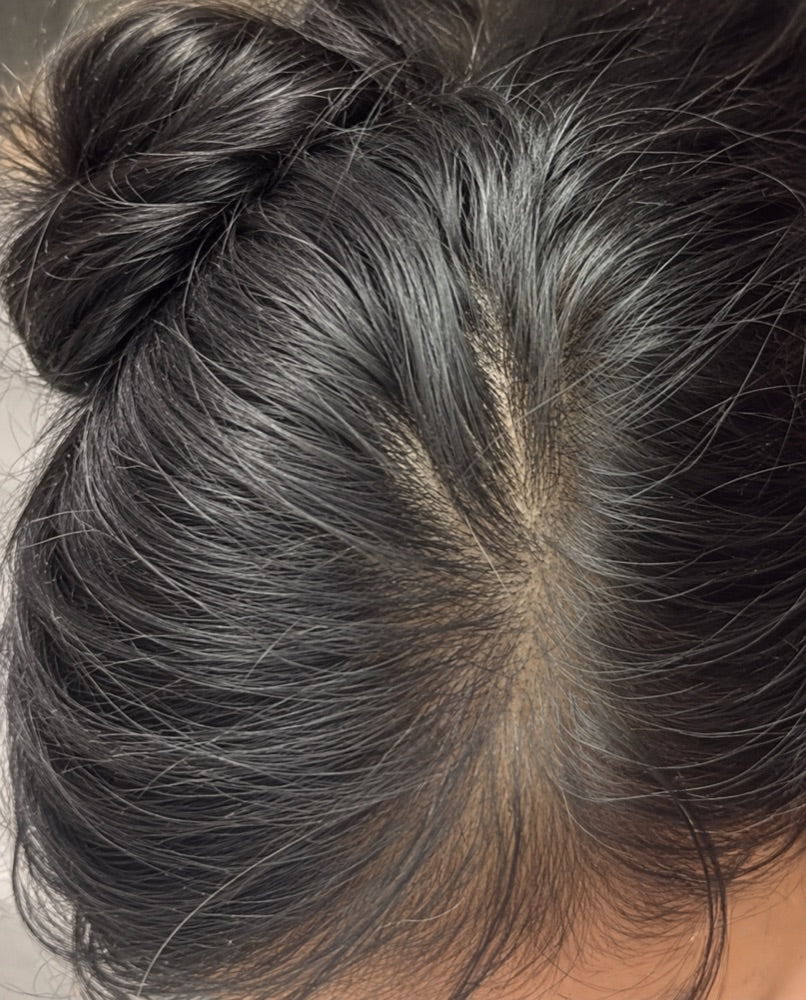 Hair Serum transformation 3 Day 45