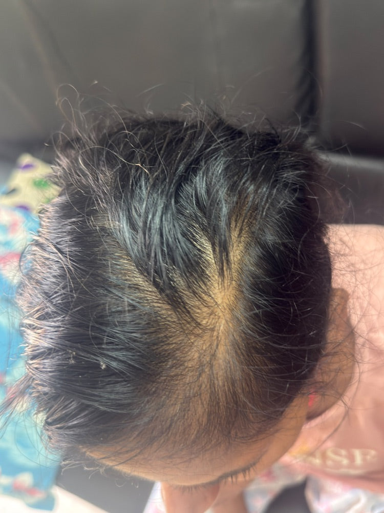Hair Serum transformation 3 Day 0